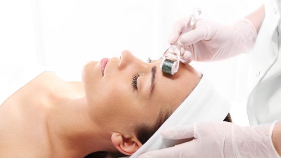 Microneedling - How It Can Help with Hair Loss